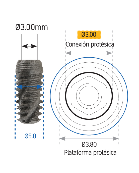 Conical connection | Vulkan Implants | Guia medidas implantes dentales | Conexión protésica | Plataforma protésica