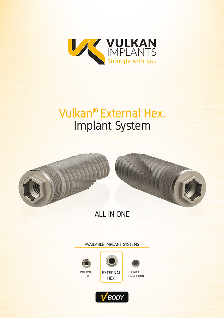vulkan-implants-catalogue-hexternal-hex