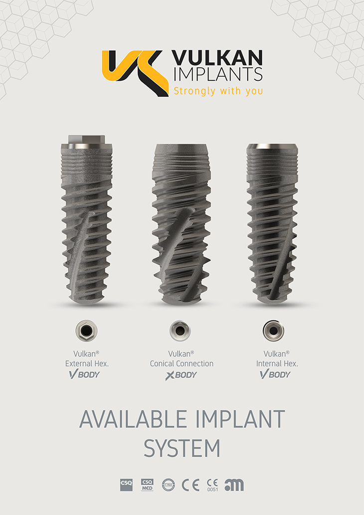 vulkan-implants-summary-catalogue- available-implant-system