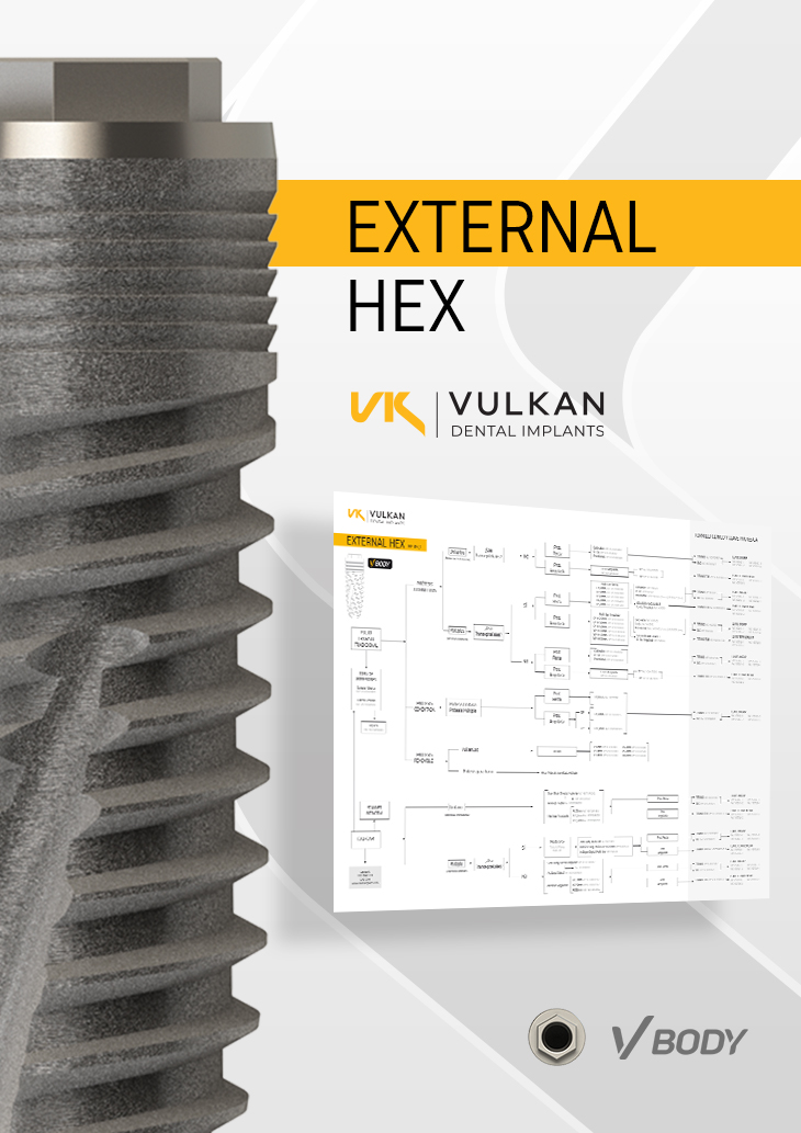 Guía Flujos de trabajo Implantes External Hex.