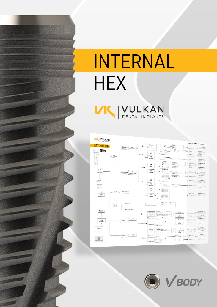 Vulkan Implants Internal Hex.